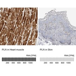 Phospholamban Antibody, Novus Biologicals 25 &mu;L; Unlabeled:Antibodies,